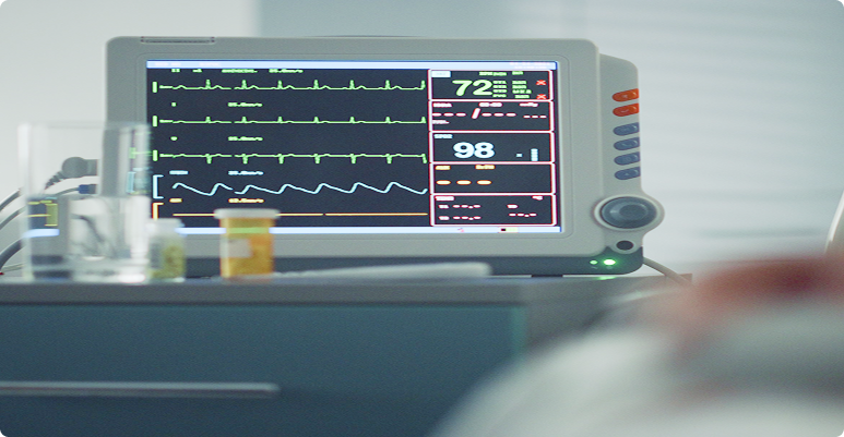 Image representing ECG (Electrocardiogram) Monitoring